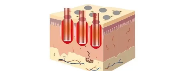 合肥华夏白癜风医院