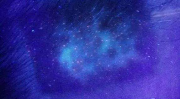 合肥华夏白癜风医院