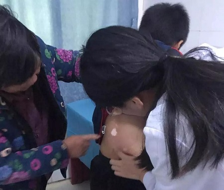 合肥华夏白癜风医院